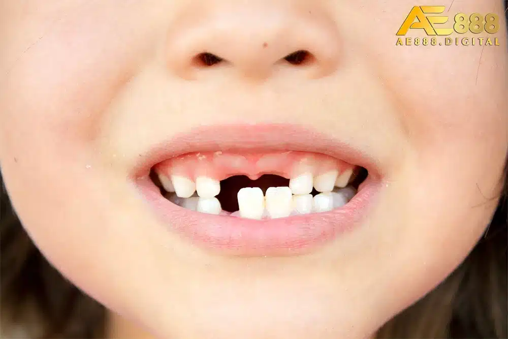 Nguyên nhân khiến nhiều người hay mơ thấy rụng răng là do lo âu, căng thẳng, áp lực trong cuộc sống hiện tại