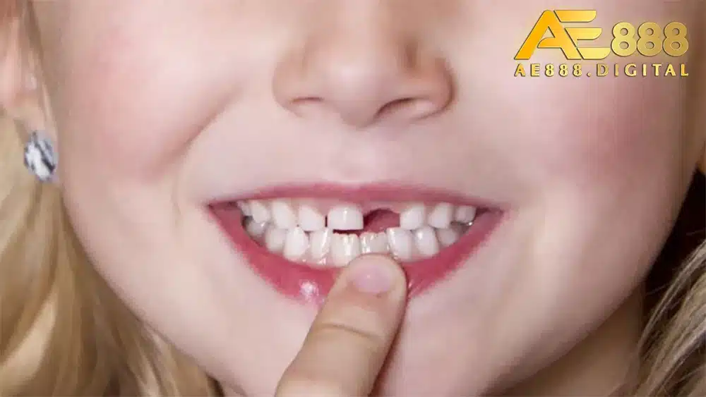 Giấc mơ thấy rụng răng mang những ý nghĩa khác nhau với từng đối tượng. Tuy nhiên, đa phần đều phản ánh mối lo âu, bất an trong tiềm thức. Bí quyết là hãy sống chậm lại, tận hưởng và trân trọng hiện tại